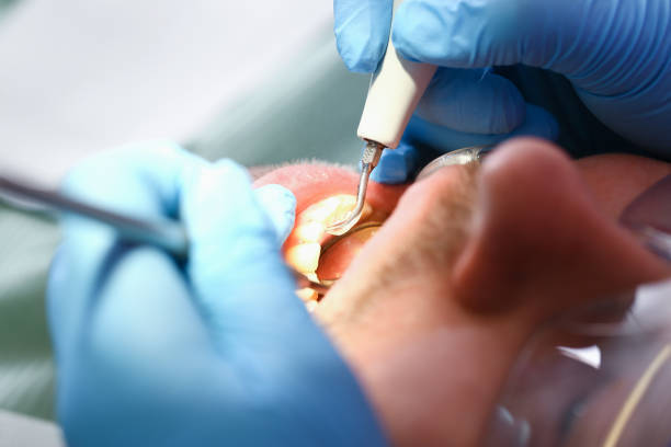 Best Knocked-Out Tooth Emergency  in Crest Hl, IL
