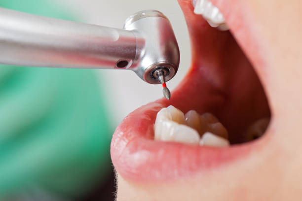 Best Chipped Tooth Repair Near Me  in Crest Hl, IL